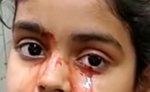 فتاة تبكي دم