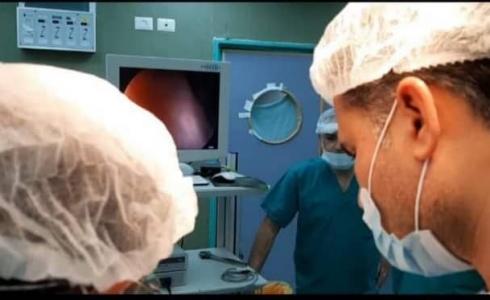 استئصال الكلية اليسرى لفتاة بالمنظار الجراحي في مستشفى شهداء الأقصى