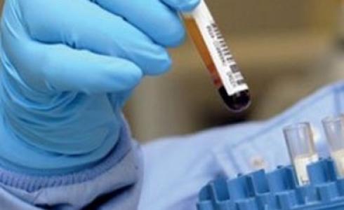 إجراء تحليل المخدرات لعاملين في مؤسسات الدولة