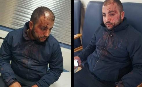 مستوطنون يعتدون على سائق مقدسي بالضرب المبرح