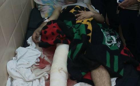 جريح من غزة : وقفة احتجاجية يوم الخميس للمطالبة بتوفير تحويلات طبية خارج غزة 