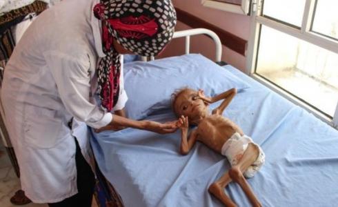 صورة توضيحية