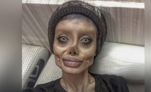 الشابة سحر طبر بعد خضوعها لعمليات التجميل