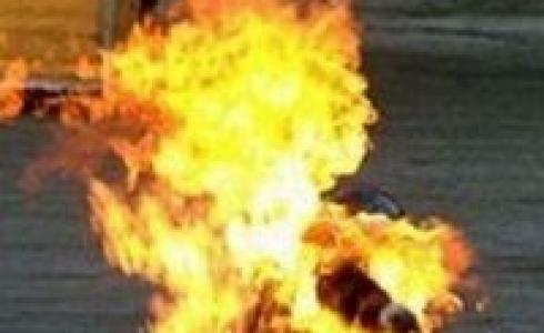 رفضت عرضه للزواج فأشعل النار بجسدها