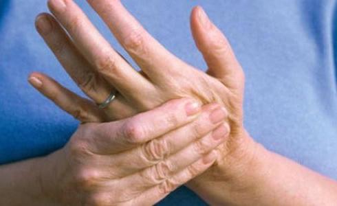 مرض ضعف الاعصاب