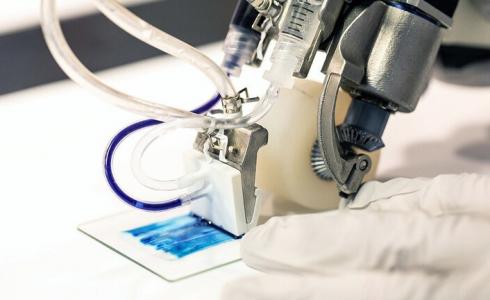 لعلاج الحروق الشديدة دون ترقيع الجلد