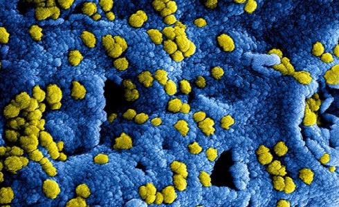 دراسة أمريكية تثير الجدل حول إمكانية علاج فيروس كورونا بالضوء