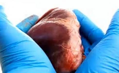 تقنية جديدة تعيد النبض لقلوب الموتى