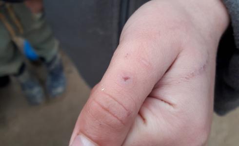 معاناة جديدة تضاف لواقع أهالي مخيم أعزاز