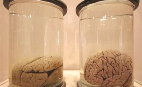 حفظ الأدمغة