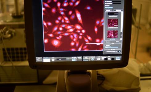 محامي بريطاني يحذر من خطر يهدد النساء في منتصف العمر