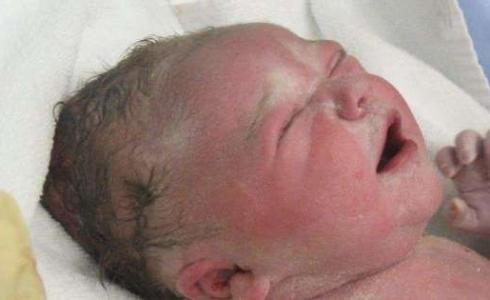 دراسة علمية  لتطوير الفحص  الطبي  عند الولادة  يمنع من الاصابة بالأمراض