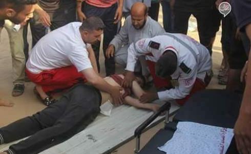 والد طفل جريح يناشد وزير الصحة علاج ابنه في الخارج 