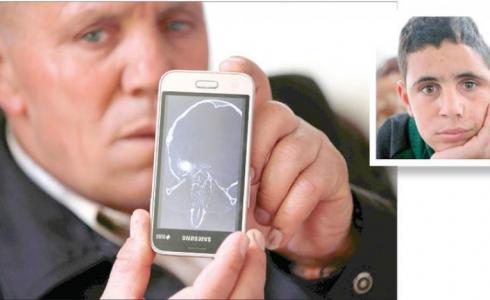 الطفل محمد التميمي