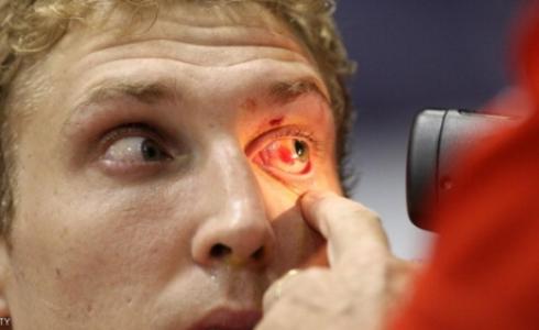 الجلوس لفترة طويلة أمام الحاسوب يعرض لعدة متاعب صحية