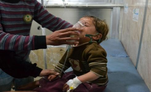 طفل مصاب في خان شيخون