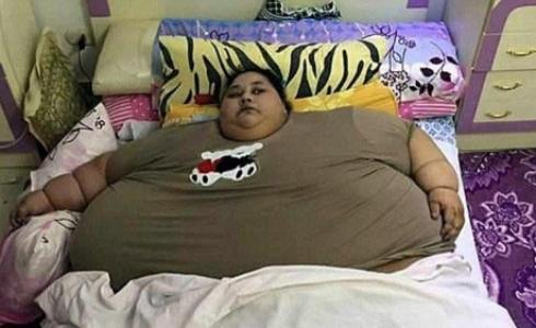 يتوقع الأطباء أن تتمكن إيمان من خسارة 400 كليوغرام في عامين.