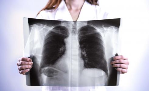 صورة أشعة سينية