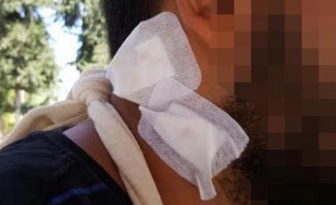 النيابة العامة تقضي بأحكام مخففة لمتهمين يهود بالاعتداء على عرب