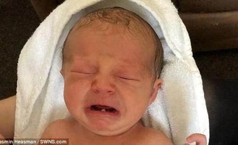 جراحة أسنان لمولودة 12 يوما في بريطانيا