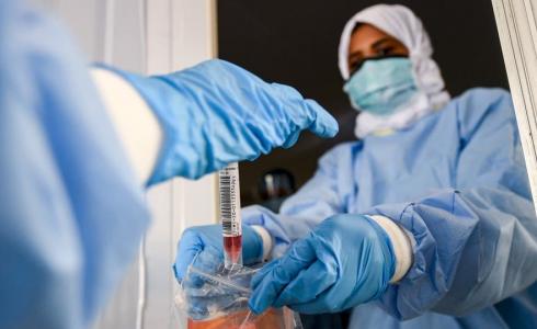 كورونا في الإمارات 