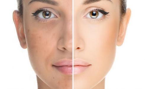 نظارة البشرة - الاهتمام بالبشرة 