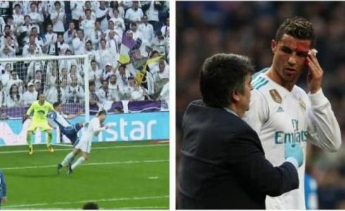 'الدماء' تغرق وجه كريستيانو رونالدو!