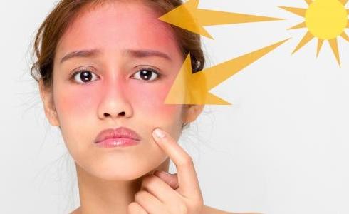 البشرة وأشعة الشمس