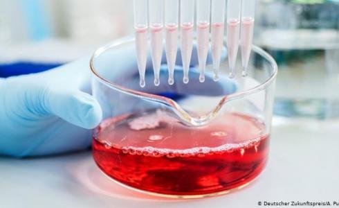 دراسة ألمانية: جهاز المناعة قد يزيد فيروس كورونا شراسة