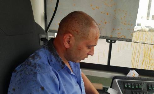 متطرفون يهود يهاجمون سائق حافلة من كفر قاسم