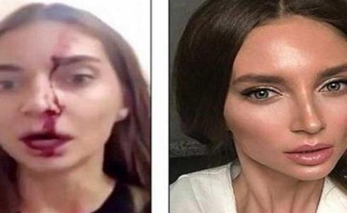 تعرض الممثلة الروسية فالتينا سيدور للضرب المبرح