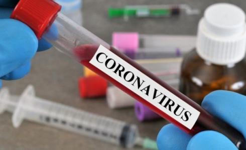 فحص فيروس كورونا - كوفيد 19