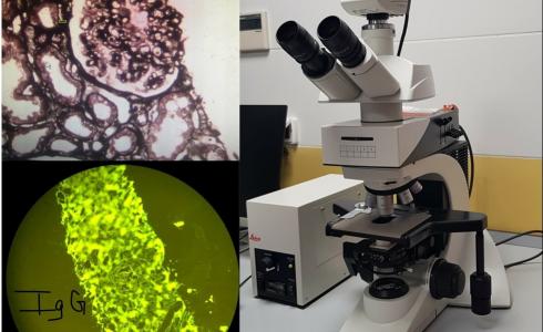 المجهر المناعي. الكلى