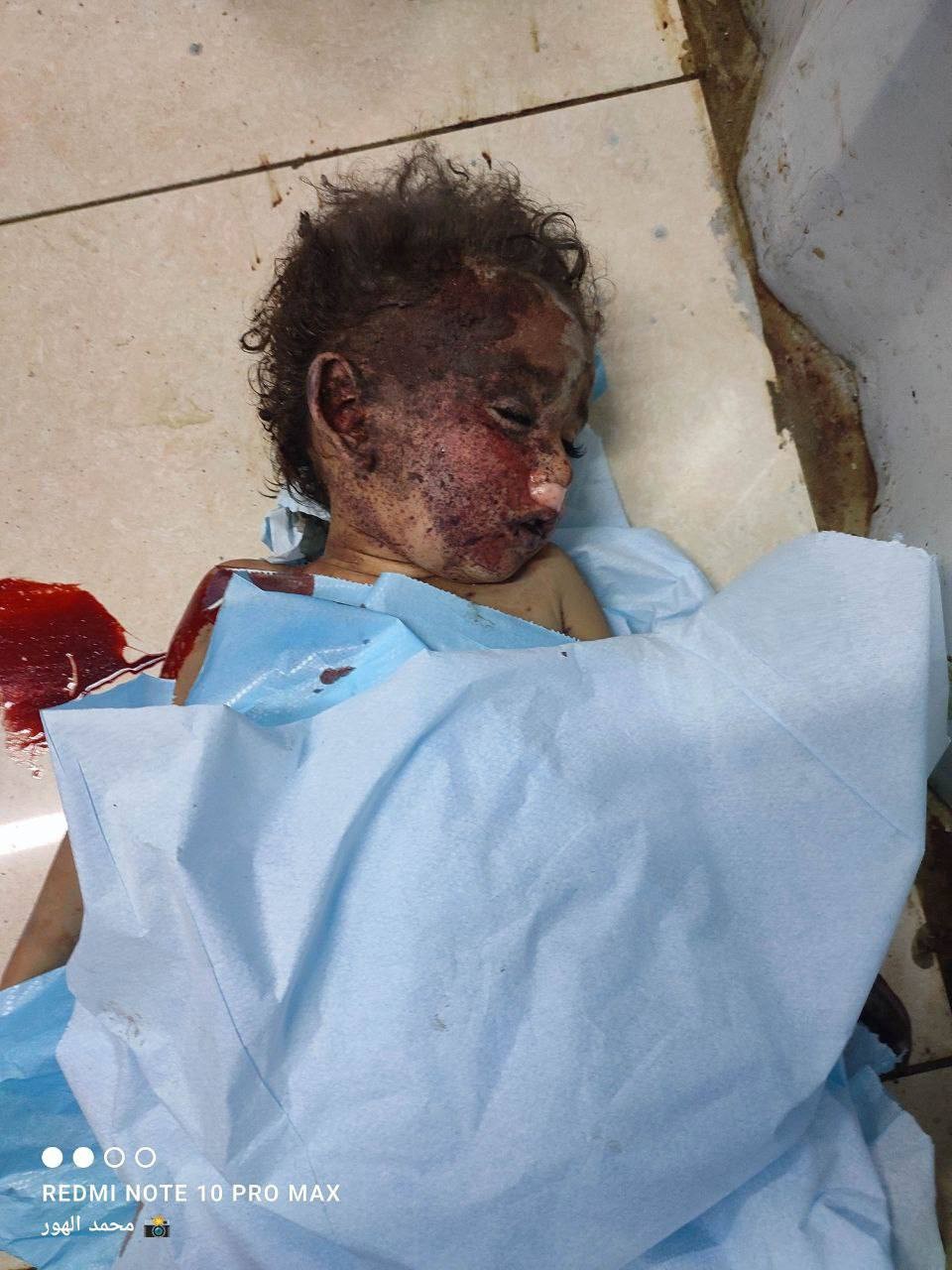 محدث: بينهم 24 طفلا - 65 شهيدا غارات إسرائيلية على قطاع غزة